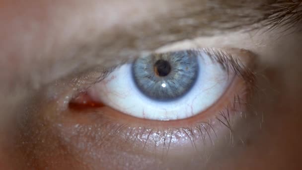Blaues Auge mit Kontaktlinse. — Stockvideo
