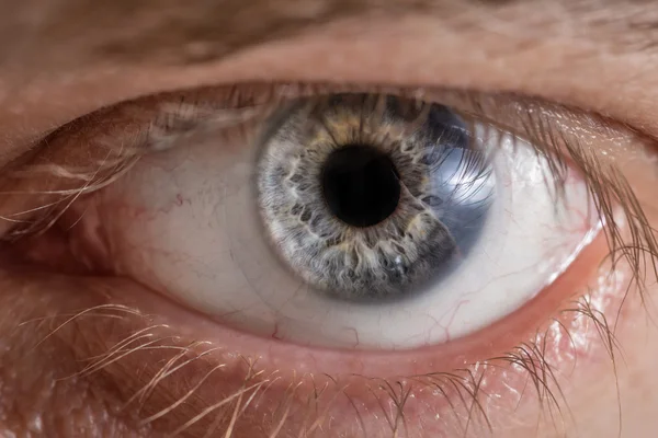 Eye with contact lens. — Stock Photo, Image