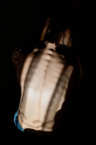 Girl Anorexia Turned Back Spine Ribs Visible Young Woman Anorexia — Stock Photo, Image
