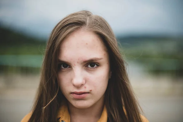 Portret Van Jonge Mooie Schattige Tienermeisje Vrouw Met Frackles Problematische — Stockfoto