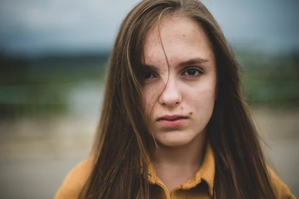 Портрет Молодої Красивої Дівчини Підлітка Тріщинами Проблемною Шкірою Природному Тлі — стокове фото