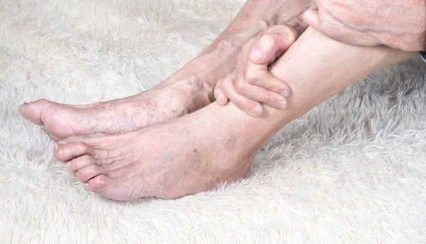 Kanepede oturan ve bacak ağrısından muzdarip yaşlı adamın kırpılmış görüntüsü. Eklem iltihabı, eklem iltihabı veya artrosit.