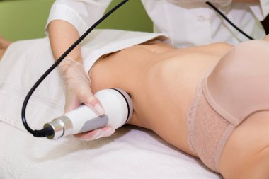 Vücudun sorunlu bölgelerinin kaldırılması için radyasyon gereklidir. RF karın kaldırma.