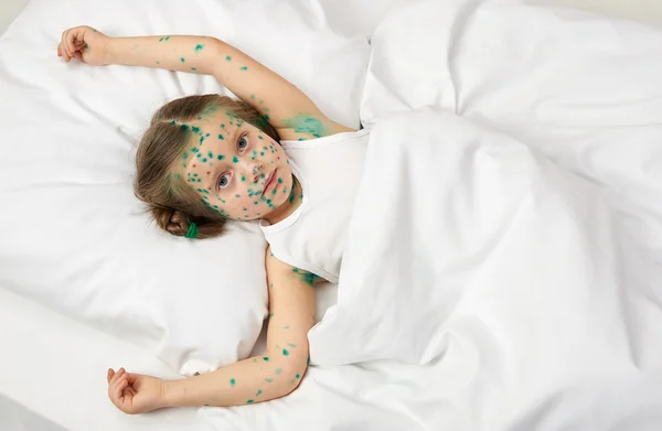 Copilul bolnav are virusul pe piele — Fotografie, imagine de stoc