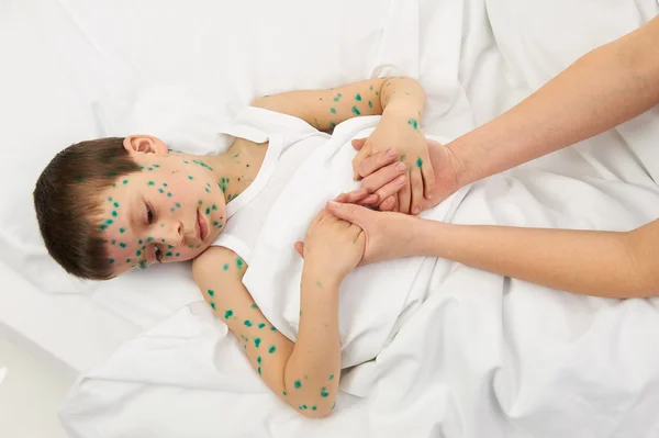 बिस्तर में बीमार बच्चे के पास त्वचा पर वायरस होता है — स्टॉक फ़ोटो, इमेज