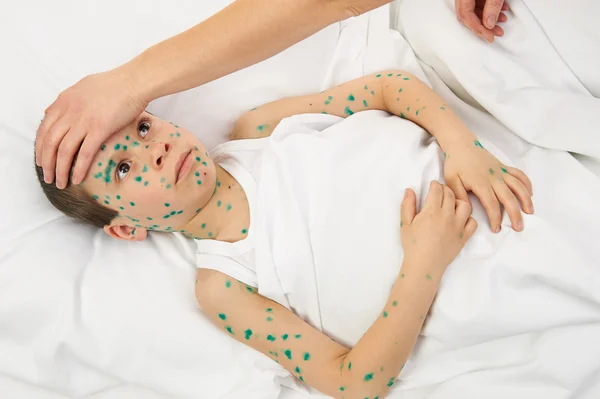 Sick child in bed has the virus on skin — Stock Photo, Image