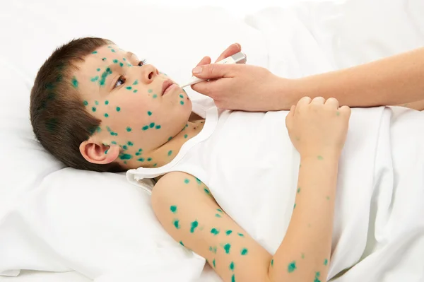 बिस्तर में बीमार बच्चे के पास त्वचा पर वायरस होता है — स्टॉक फ़ोटो, इमेज