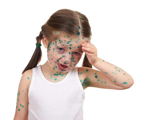 Krankes Kind hat das Virus auf der Haut — Stockfoto