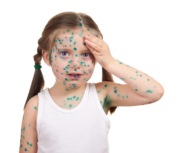 病気の子供は、皮膚のウイルス — ストック写真