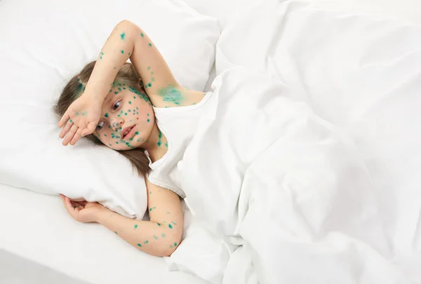 Sick child has the virus on skin — Stock Photo, Image