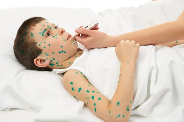 Sick child in bed has the virus on skin — Stock Photo, Image