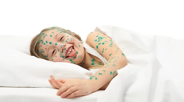 Chore dziecko ma wirusa na skórze — Zdjęcie stockowe