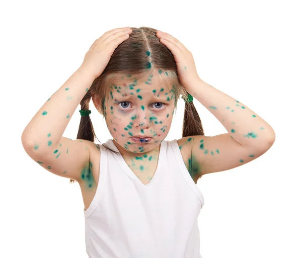 Nemocné dítě má virus na kůži — Stock fotografie