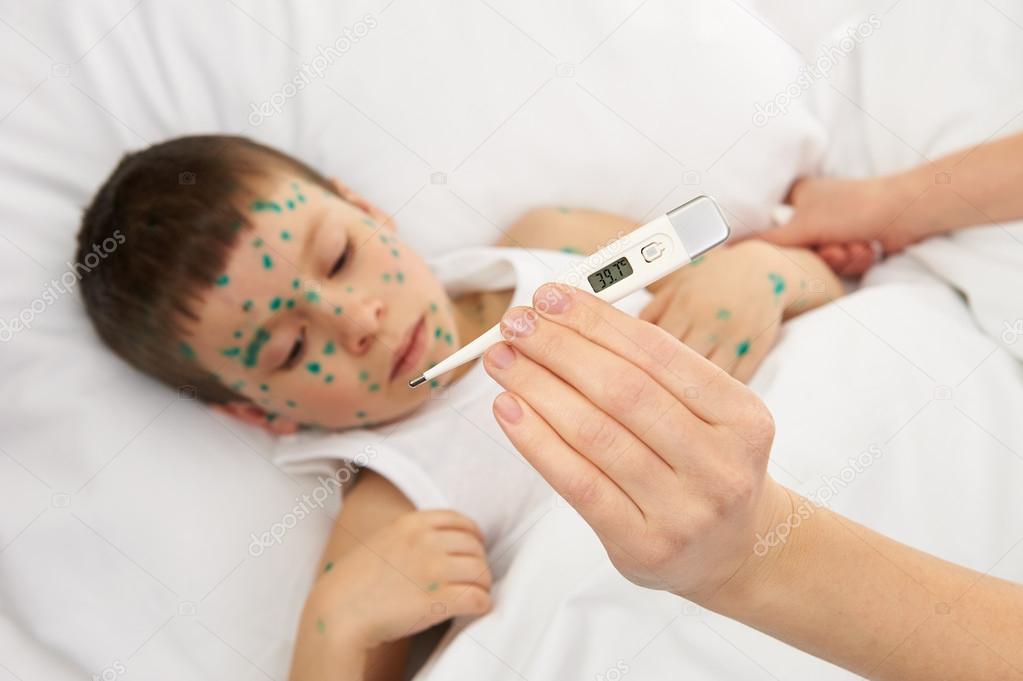 sick child in bed has the virus on skin