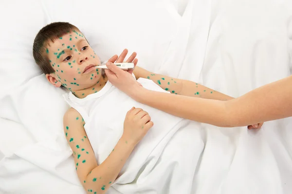 Criança doente na cama tem o vírus na pele — Fotografia de Stock