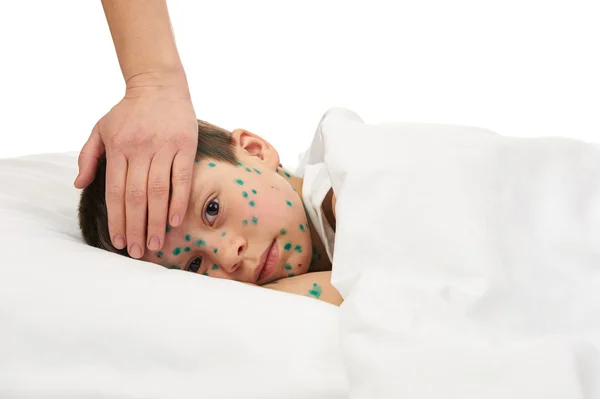 Sick child has the virus on skin — Stock Photo, Image