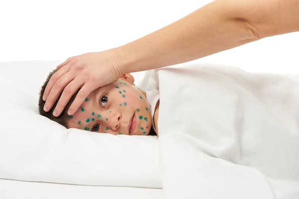 Sick child has the virus on skin — Stock Photo, Image