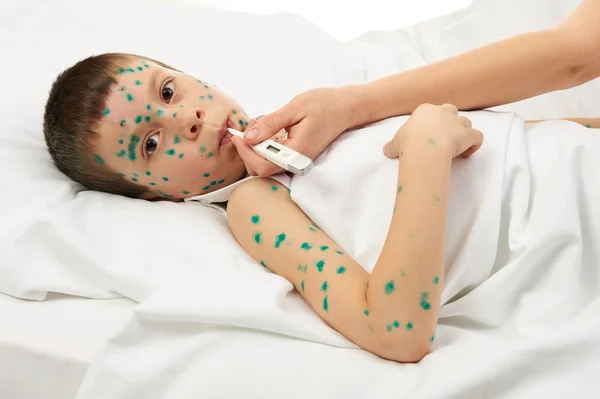 Niño enfermo en la cama tiene el virus en la piel —  Fotos de Stock