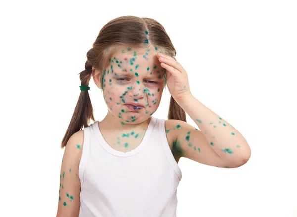 Child has the virus on skin — Stock Photo, Image