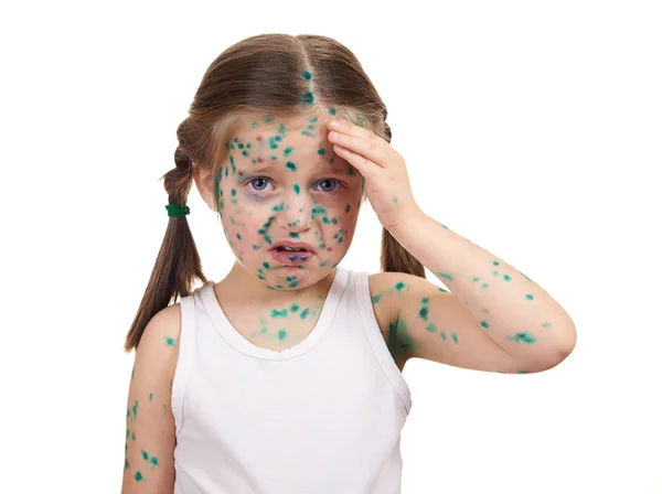 Child has the virus on skin — Stock Photo, Image