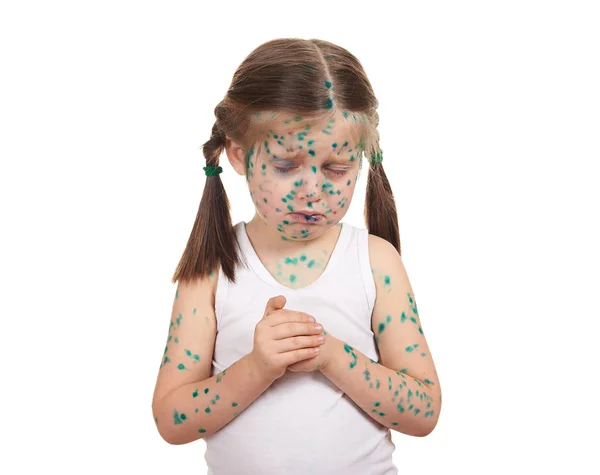 Child has the virus on skin — Stock Photo, Image