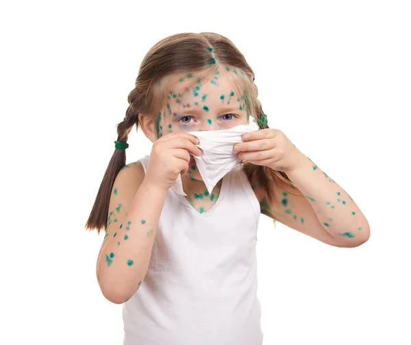 Child has the virus on skin — Stock Photo, Image