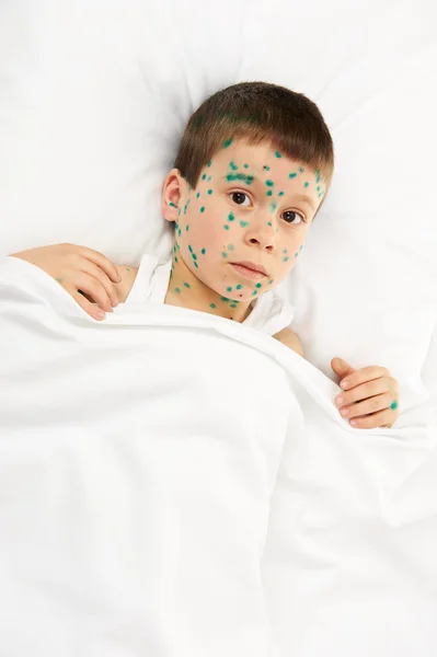 Child has the virus on skin — Stock Photo, Image