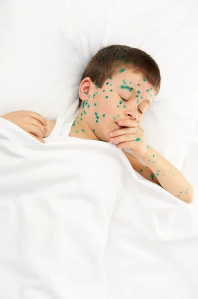 Child has the virus on skin — Stock Photo, Image