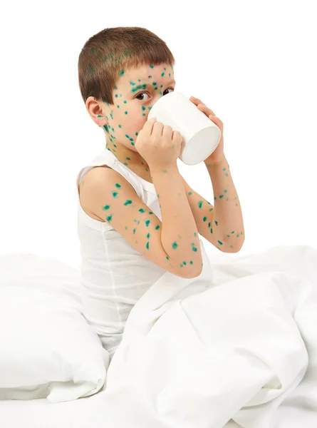 Child has the virus on skin — Stock Photo, Image