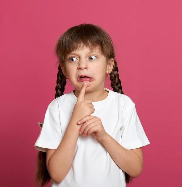 Lost tooth girl child portrait  on pink background Royalty Free Stock Photos