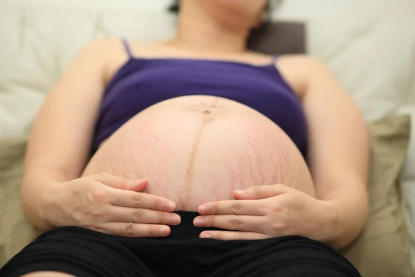 Gros plan du ventre de la femme enceinte avec une peau fissurée — Photo