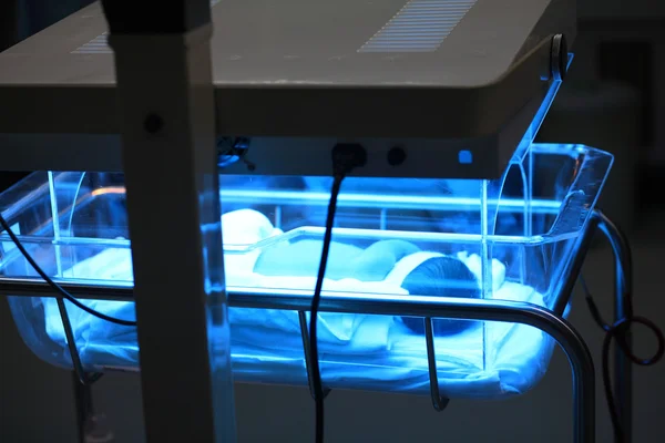 Newborn being treatment by ultraviolet light to solve jaundice — Stock Photo, Image