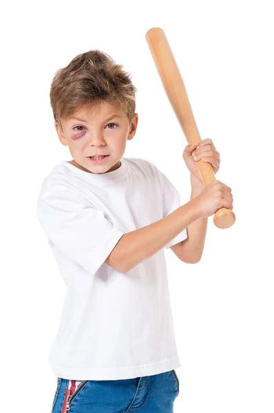 Boy with bruise — Stock Photo, Image