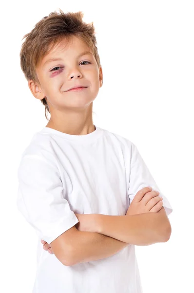 Portrait of boy with bruise — Stock Photo, Image