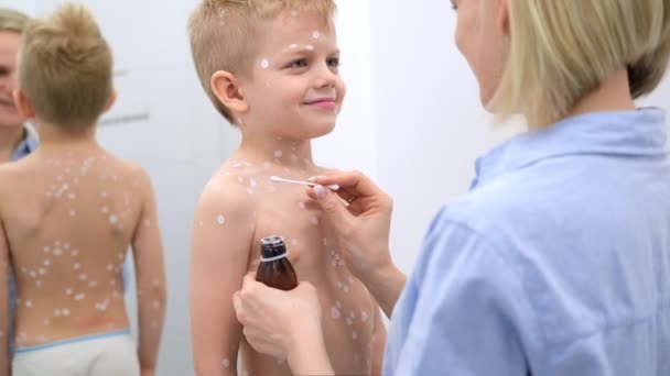 Moeder die ontsmettende crème op de huid van haar zoon aanbrengt. Varicella virus of waterpokken zeepbel huiduitslag bij kind. — Stockvideo