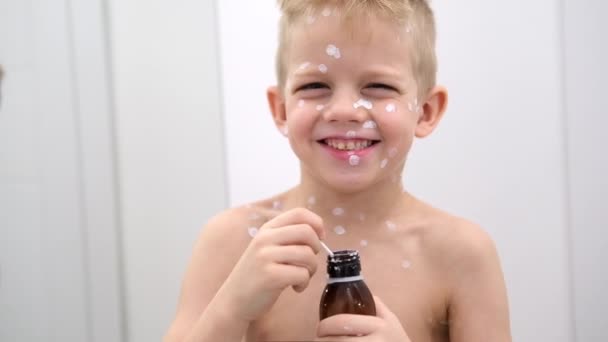 Pequeño niño feliz con el virus de la varicela o la varicela erupción burbuja sonriendo a la cámara — Vídeos de Stock