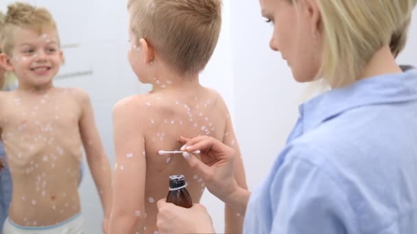 Madre aplicando crema antiséptica sobre la piel del hijo. Virus de la varicela o erupción por burbuja de varicela en el niño. — Vídeos de Stock