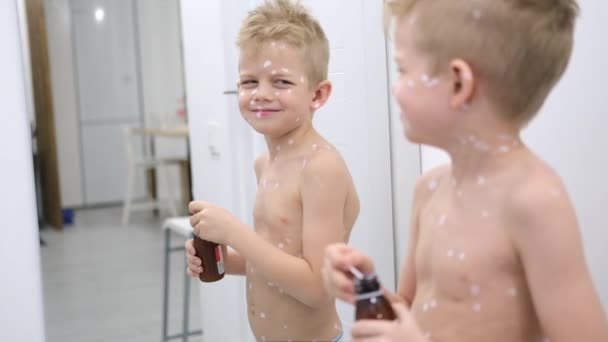 Little Boy examina a si mesmo no espelho. Varicela vírus ou varicela borbulha erupção na criança. Criança rindo feliz com pomada na pele — Vídeo de Stock