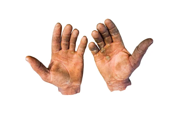 Injured open palms — Stock Photo, Image