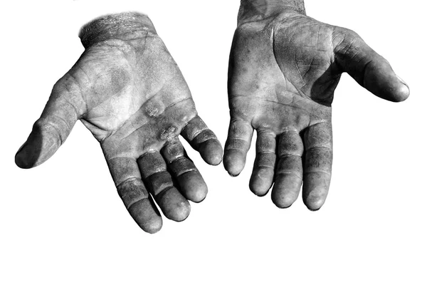 Injured open palms — Stock Photo, Image