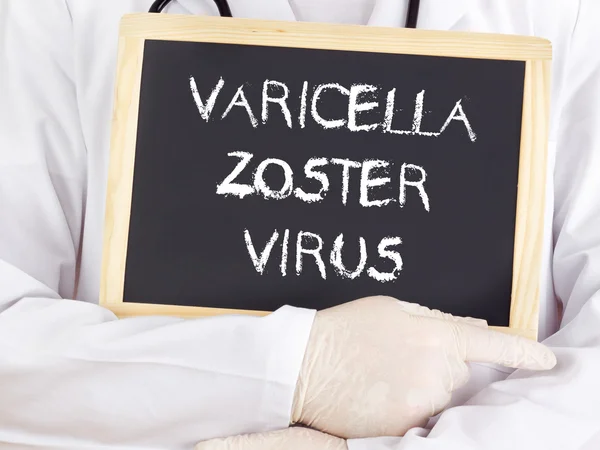 Doctor ukazuje informace: neštovice zoster virus — Stock fotografie