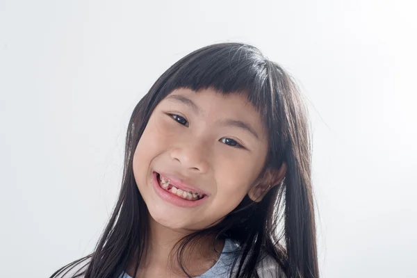 Asian child has lost the baby tooth — Stock Photo, Image