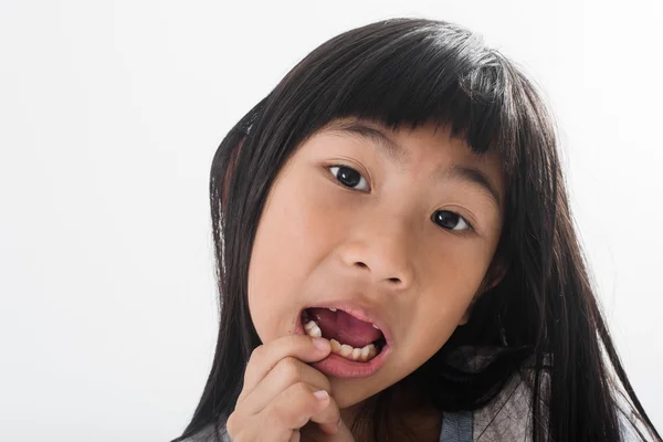 Asian child has lost the baby tooth — Stock Photo, Image