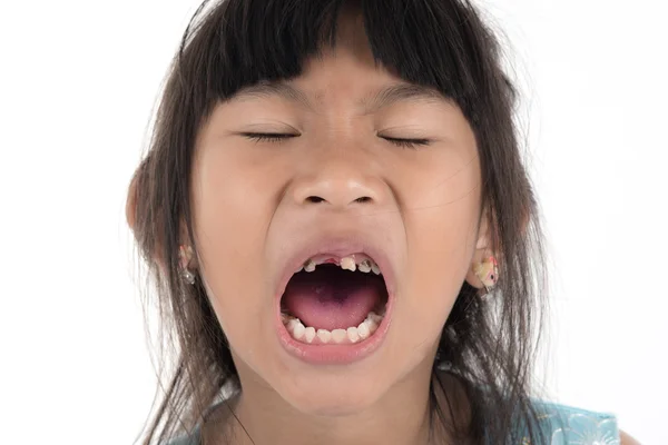 6 years old child has lost the baby tooth. The girl is holding t — Stock Photo, Image