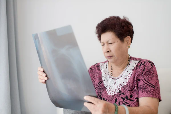 Mujer mayor mirando rayos X —  Fotos de Stock