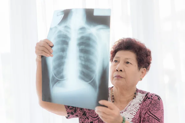 Senior vrouw kijken naar x-ray — Stockfoto