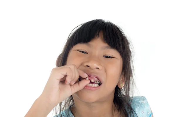 Il bambino di 6 anni ha perso il dente del bambino. La ragazza sta tenendo t — Foto Stock