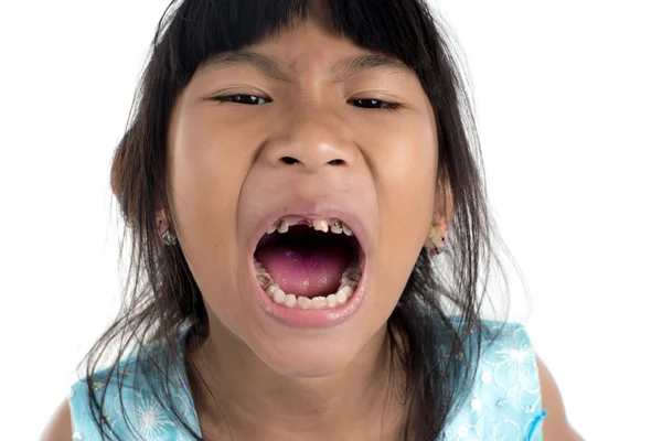 6 years old child has lost the baby tooth. The girl is holding t — Stock Photo, Image