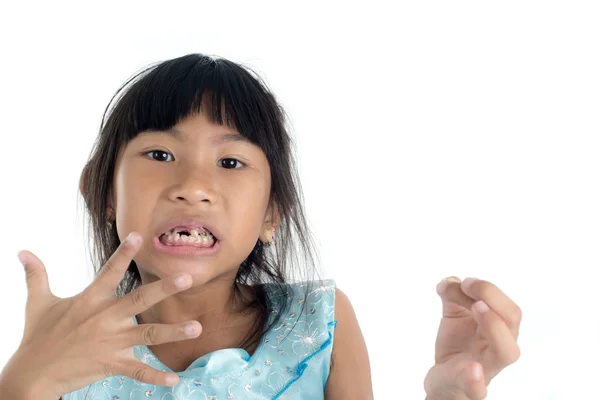 6 years old child has lost the baby tooth. The girl is holding t — Stock Photo, Image