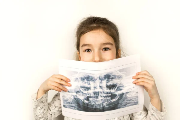 Mädchen Hält Ihr Röntgenbild Mit Einem Panorama Von Babyzähnen Und — Stockfoto